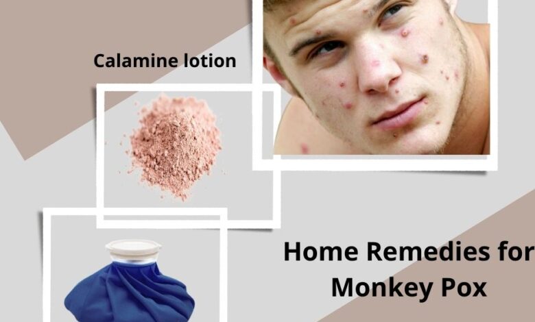 Home-Remedies-for-Monkey-Pox