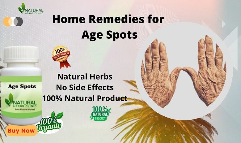 Home Remedies for Age Spots