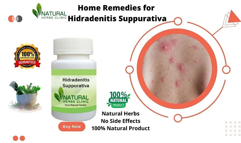 Home Remedies for Hidradenitis Suppurativa