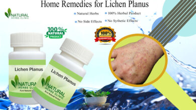 Home-Remedies-for-Lichen-Planus-1