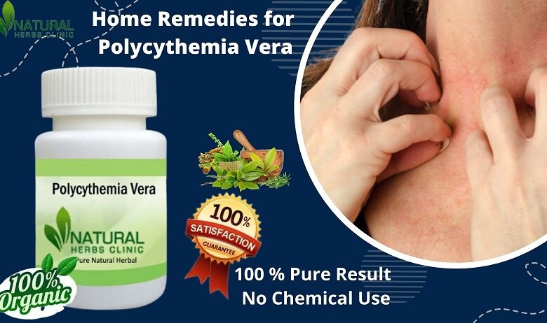 Home Remedies for Polycythemia Vera