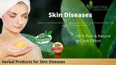 Home-Remedies-for-Skin-Diseases