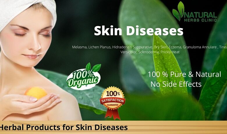 Home-Remedies-for-Skin-Diseases