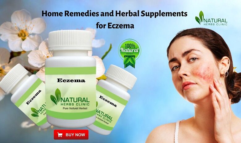 Herbal Supplements for Eczema