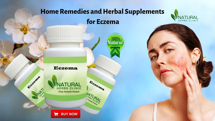 Herbal Supplements for Eczema