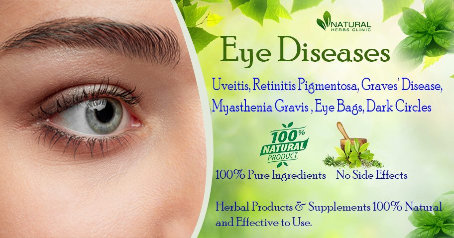 Eye Disease Suitable Option to Treat with Herbal Supplements img