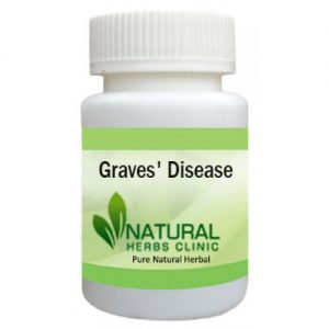 Home Remedies for Graves' Disease