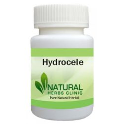 Herbal Supplements for Hydrocele