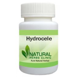 Herbal Supplements for Hydrocele Herbal Supplements for Hydrocele
