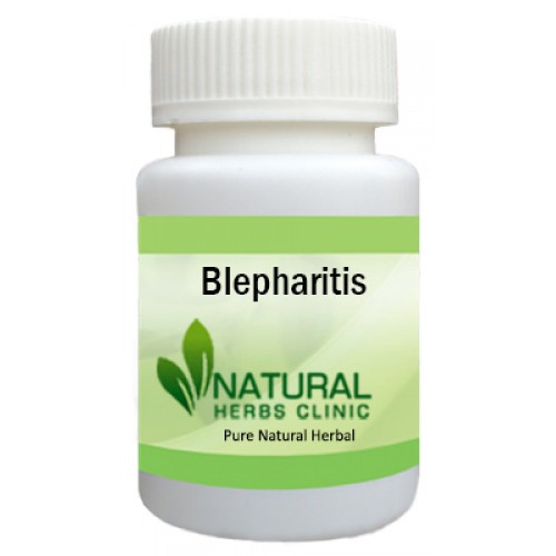 Herbal Supplements for Blepharitis