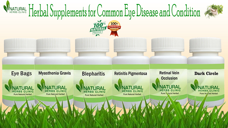 Herbal Supplements for Eye Disease