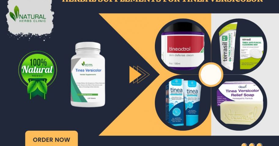 This Easy Homemade Treatment for Tinea Versicolor Will Work Wonders img