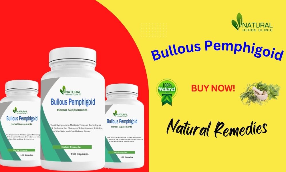 Natural Treatment for Bullous Pemphigoid