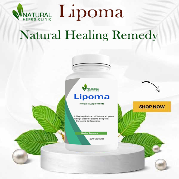 Home Remedies for Lipoma