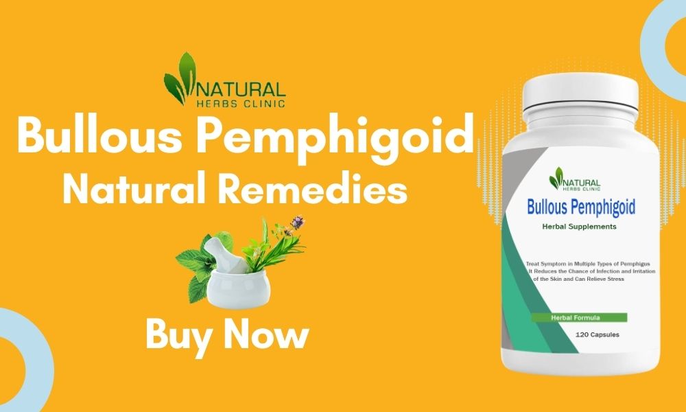 Natural Treatment for Bullous Pemphigoid