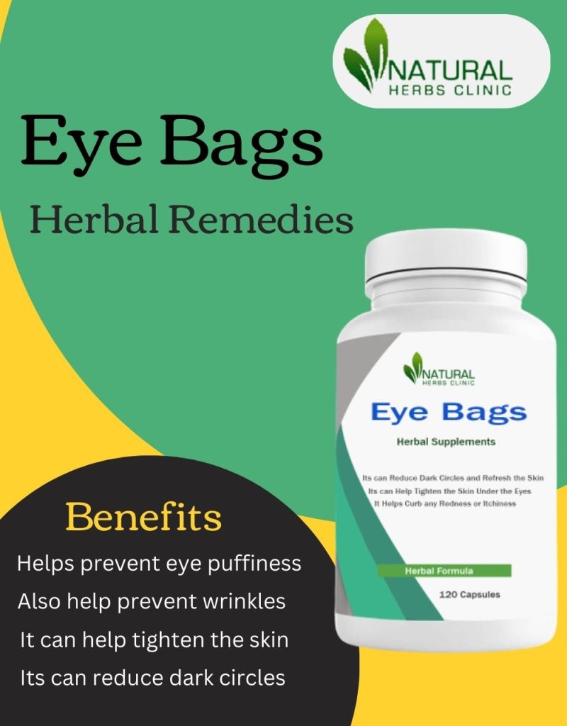 Herbal Remedies for Eye Bags