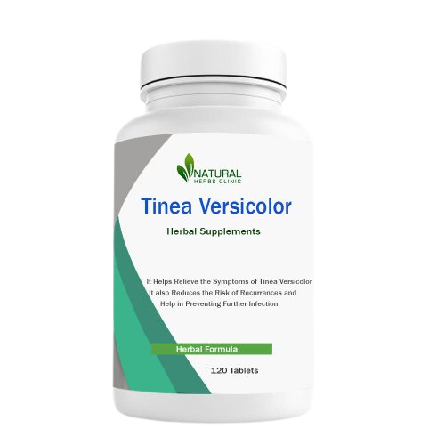 Natural Remedies for Tinea Versicolor