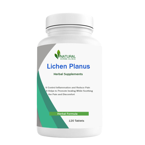 natural treatment for lichen planus