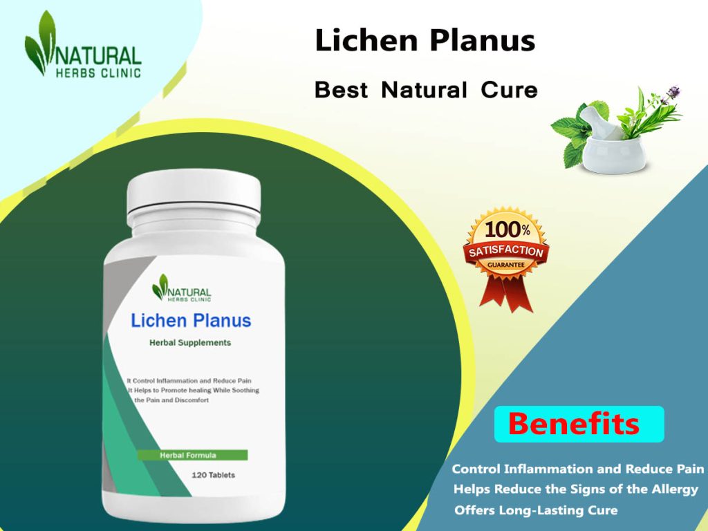 Lichen Planus Natural Treatment Best Option to Get Rid of It