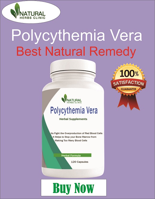 Natural Remedies for Polycythemia Vera