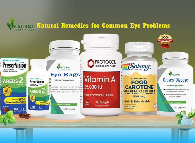 Natural Remedies for Common Eye Problems