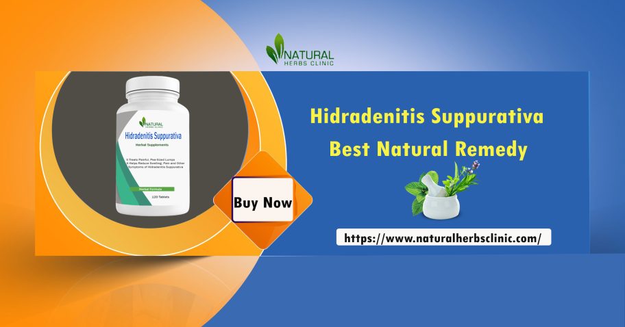 3 Effective Hidradenitis Suppurativa Treatment Home Remedies img