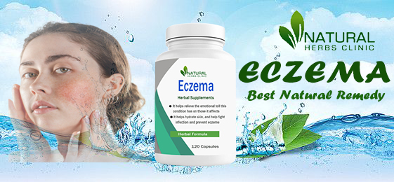 Home Remedies for Eczema on Face