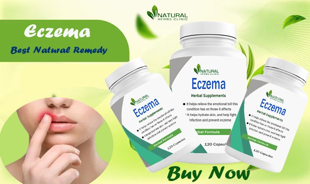Eczema Home Treatments