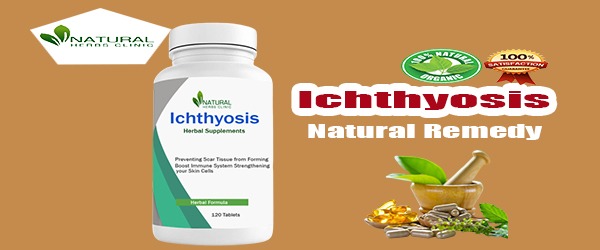 Herbal Remedies for Ichthyosis