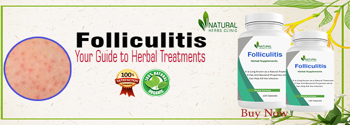 Herbal Treatment for Folliculitis