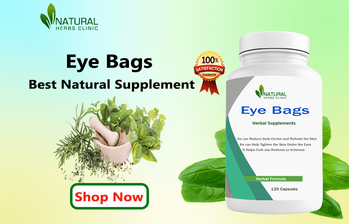 Home-Remedies-for-Eye-Bags-1