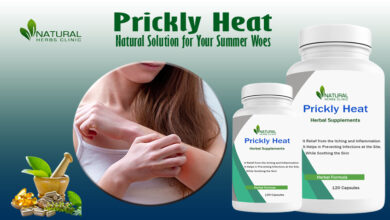 Home Remedies for Prickly Heat