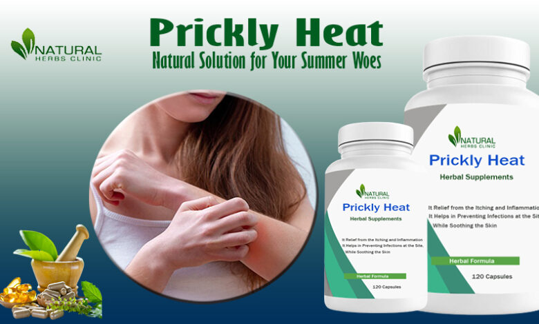 Home Remedies for Prickly Heat