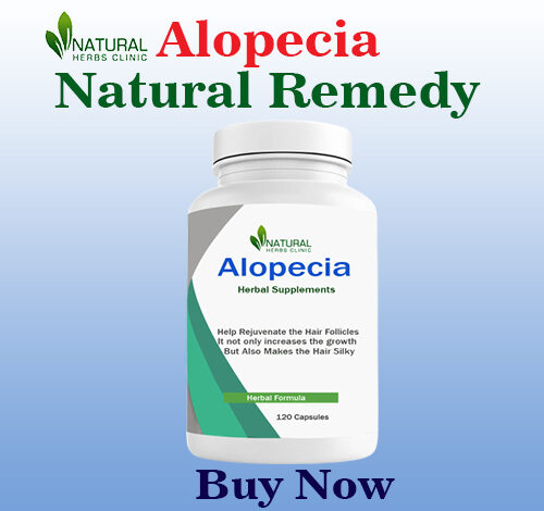 Natural Remedies For Alopecia