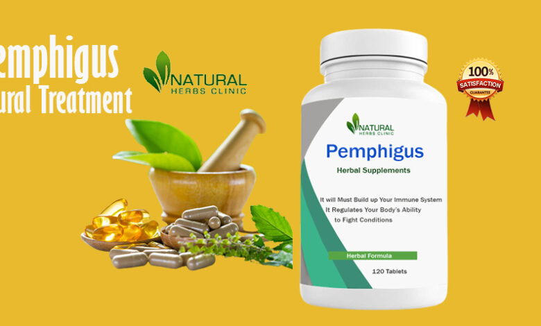 Pemphigus Natural Treatments