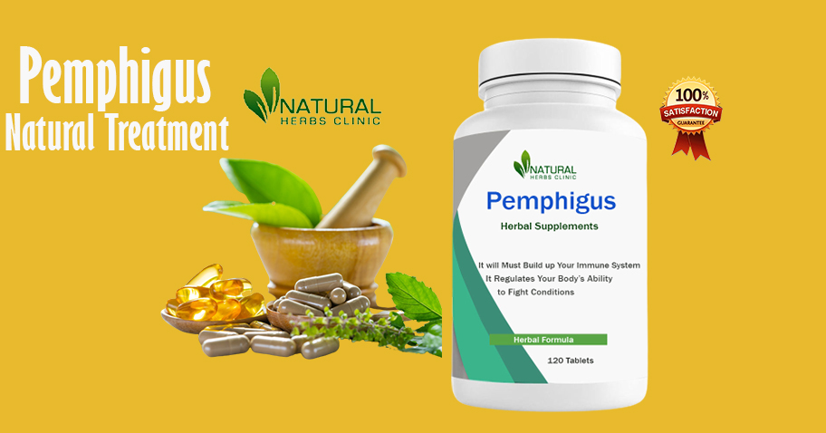 Pemphigus Natural Treatments