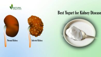 Best-Yogurt-for-Kidney-Disease-768x403