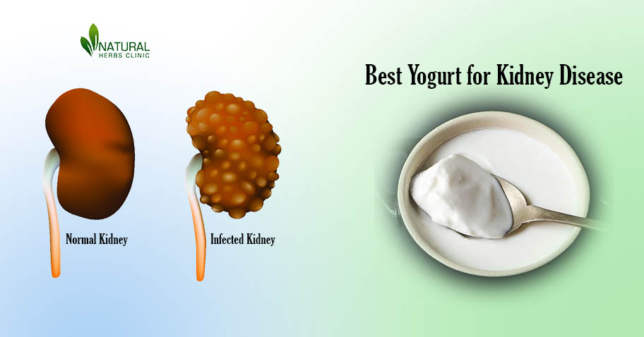 Best Yogurt for Kidney Disease