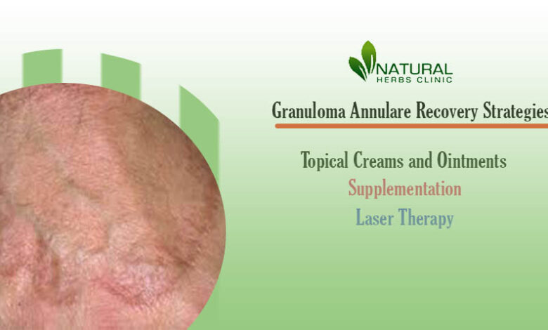 Granuloma Annulare Recovery Strategies