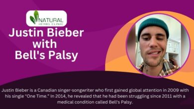 Justin Bieber Bell's Palsy