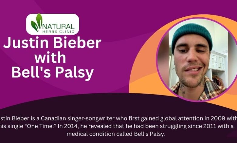 Justin Bieber Bell's Palsy