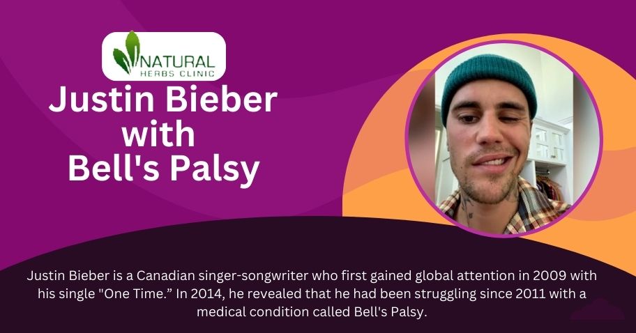 Justin Bieber Bell's Palsy