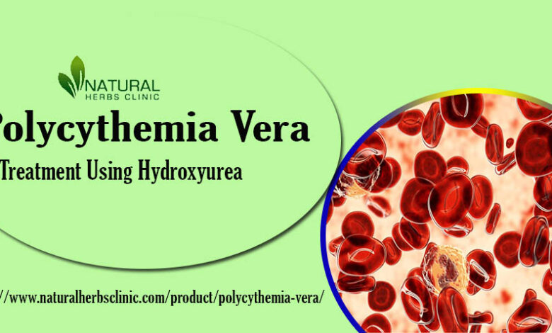 Natural Treatment For Polycythemia Vera