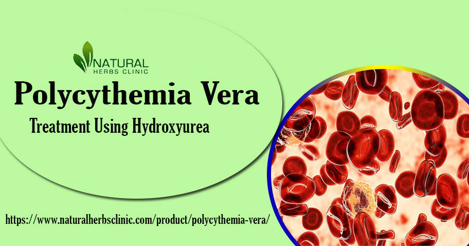Hydroxyurea for Polycythemia Vera