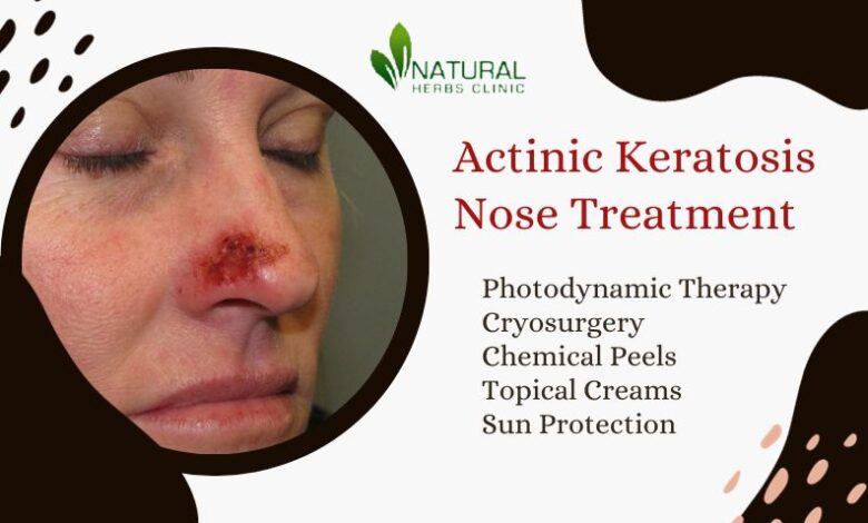 actinic keratosis nose treatment