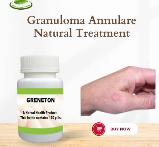 Granuloma Annulare Vitamin D