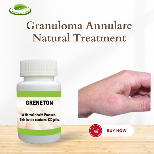 Granuloma Annulare Vitamin D Your Newest Weapon Against Ringed Red Bumps