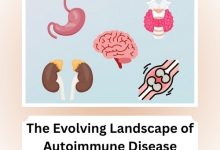 The Evolving Landscape of Autoimmune Disease Research