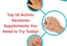 Top 10 Actinic Keratosis Supplements You Need to Try Today