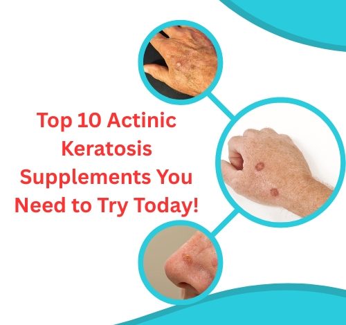 Top 10 Actinic Keratosis Supplements You Need to Try Today